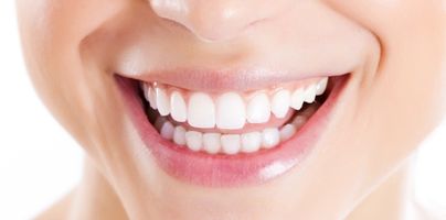 composite-fillings-2